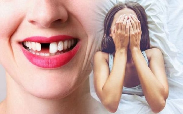 Giải mã giấc mơ thấy gãy răng Giải mã giấc mơ thấy gãy răng