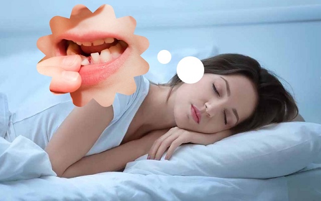Mơ thấy gãy răng cửa là sao Mơ thấy gãy răng cửa là sao